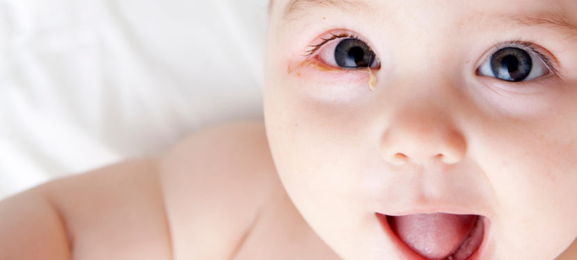 子どもの目が赤くなった〜結膜炎の原因とは？