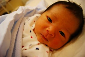 赤ちゃんの目の異常 見逃さないためのチェックリスト 小児科オンラインジャーナル