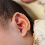 新生児聴覚スクリーニングでリファー（要再検査、要精査）となったら